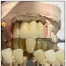 수석치과기공소 이미지