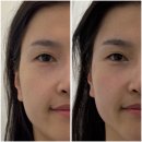 피트니스 동의보감 | 광화문 피부관리, 얼굴 근육을 깨우는 운동 페이스PT 리얼후기