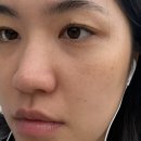 데이뷰의원의정부점 | 경기 의정부 피부과 첫방문이벤트 피코슈어토닝 ‘데이뷰의원’ 의정부점