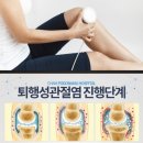 골관절염치료기 이미지