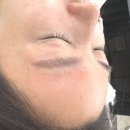 무등약국 | 광주눈썹제거 봉선동 브로우브로우 추천