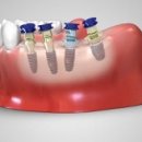 네오치과기공소 이미지