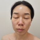 루베아 | 방이역 루베아 에스테틱 ✨️시그니처 커스터마이징 프로그램 솔직 후기