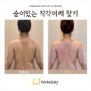 (주)비율 | 실제로 목이 길어진 목길어지는 법, 비율이 달라진 후기