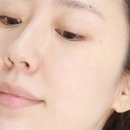 큰들마트 | 압구정 피부과 엑소스마트 후기, 자가 엑소좀으로 진짜 피부가 어려져요.