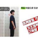 포레피티