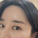 유앤아이의원 | 평택 비전동 / 소사벌 피부과 유앤아이의원 스킨보톡스 통증 및 후기