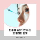 비트윈성형외과