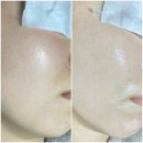 온어시즌에스테틱 부산서면점