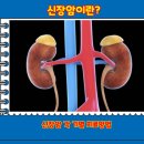 [신장암 증상과 1기 2기 3기 4기 완치 확률 치료방법] 이미지