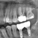 이로운치과기공소 이미지