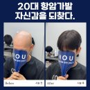 서울아산병원(20대) | 서울아산병원 근처 가발 전문 업체, 강동구 20대 남자항암가발 후기(가격할인 안내)