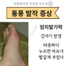 통풍 증상 및 통증 치료 이미지