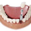 탑치과기공소 이미지