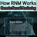 Remote Neural Monitoring(RNM) 이미지