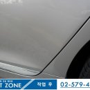 덴트존 이미지