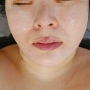 여신뷰티 | 울산 얼굴 탄력관리 여신뷰티 온웨이브리프팅 리얼 후기