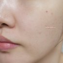 (주)피플글로우 | 올리브영 시카크림 간증템 후기 + 사진 有