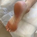 푸스케어 남양주다산점 | 족압,보행 측정해주는 발 관리 전문샵에서 발각질제거 받고온 후기/남양주 다산 푸스케어