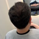 서면탈모펌 고민이 있다면 무조건 모여야 한다구요!
