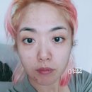 인생역전인셀덤 | 인셀덤 여드름흉터 각질피부 개선 찐후기
