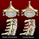 척추~경추-흉추-요추-천골-미골 이미지