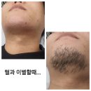 왁싱#남원슈가왁싱#남원슈가링왁싱#슈가왁싱#슈가링#남원남자왁싱#남원여자왁싱#남원임산부왁싱...