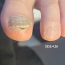 한성대역 6번출구 | 갔다가... 내 발이 인생을 찾았어요”문제성손발관리 진짜 잘하는 곳, 발산역6번출구 여우콩네일 후기