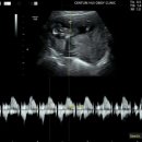 센텀희여성의원 이미지