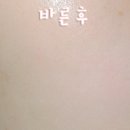 브이아이피테라피