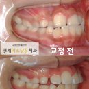 연세미소담은치과 이미지