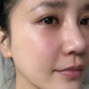 수부지 속건조 잡는 오일프리 앰플추천, 미르의 힐링 앰플 한방화장품 리얼후기