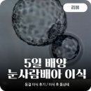강동성신의원 | [신혼부부난임일기] 5일배양 눈사람배아 동결이식후기- 이식후 7일간 몸상태 / 며칠차부터 임테기?