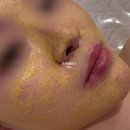 온양지구대 | 천안 아산 용화동 피부관리 추천 | 빛날희에스테틱 골드테라피 후기