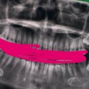 불꽃치과의원 이미지