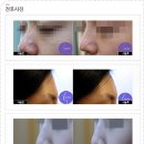 필미즈의원 네이버블로그