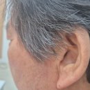 하나히어링보청기 동대문센터 이미지