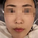 서산 피부관리 스무살 피부처럼 ★ &lt;feat. 스무살에 머물다 석림점&gt;