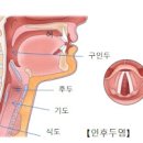 목에뭐가 걸린 느낌 원인 3가지 이미지