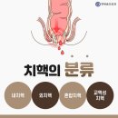 이 외과 네이버블로그
