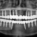 애프터기공소 이미지