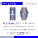 하지정맥류, 유독 한쪽 다리에서 심하게 나타나는 이유는? 이미지