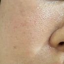 프롬코코 | [피부관리 - 프롬미 남위례점 내돈내산]