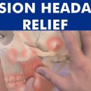 근막통증증후군(MPS) 치료 — 물리치료로 트리거포인트 완화하는 방법 이미지