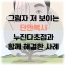단안 | [대전 단안 복시 전문] 이미지가 두 개로 보이는 증상 안경으로 개선해 드렸습니다.