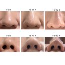 서울퀸성형외과의원 이미지