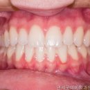 강남 치과 연세굿데이치과의원 수서점 전문가의 선택으로