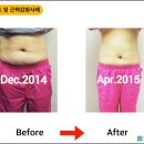 닥터코르셋 이미지