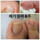메가원
