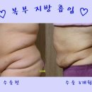 미소인